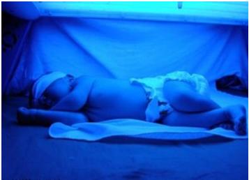 infant photo therapy unit3(تعميرات فتو تراپ)